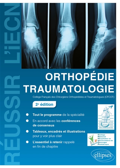 Orthopédie Traumatologie - 2e édition (Broché)