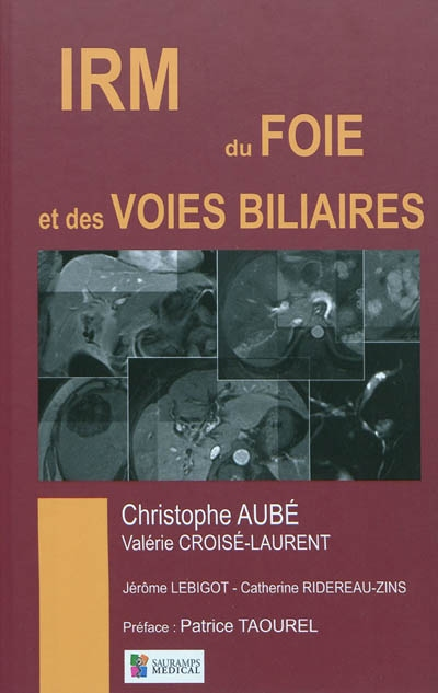 IMAGERIE DU FOIE ET DES VOIES BILIAIRES (Relié)
